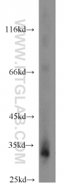 24168-1-AP - XBP1 / TREB5