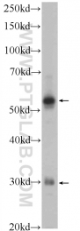 24868-1-AP - XBP1 / TREB5