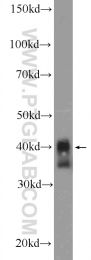 16462-1-AP - XPA / XPAC