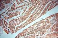 12915-1-AP - XPO1 / Exportin-1