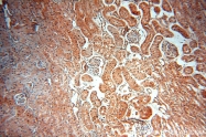 12915-1-AP - XPO1 / Exportin-1