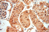 12915-1-AP - XPO1 / Exportin-1