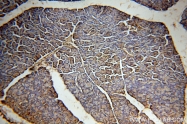 12915-1-AP - XPO1 / Exportin-1
