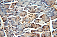 12915-1-AP - XPO1 / Exportin-1