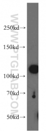12915-1-AP - XPO1 / Exportin-1