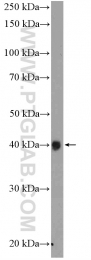 20285-1-AP - XRCC2
