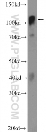 14392-1-AP - YTHDC1