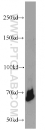 22156-1-AP - YY1