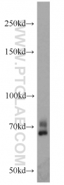 22156-1-AP - YY1