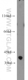 14679-1-AP - ZADH2