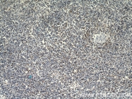 15592-1-AP - ZAP70