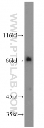 15592-1-AP - ZAP70