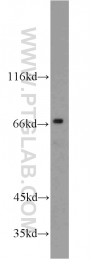 15592-1-AP - ZAP70