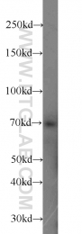 15592-1-AP - ZAP70