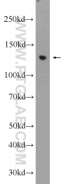 22944-1-AP - ZBTB10