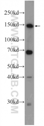25215-1-AP - ZBTB11