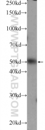 25631-1-AP - ZBTB25