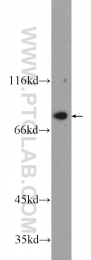 24665-1-AP - ZBTB48