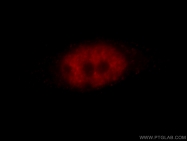 11341-1-AP - ZBTB7B