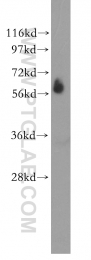 11341-1-AP - ZBTB7B