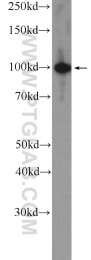26081-1-AP - ZC3H11A