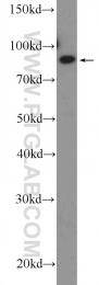 26081-1-AP - ZC3H11A