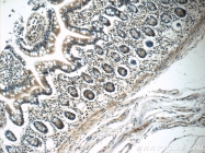 25009-1-AP - ZC3H12A