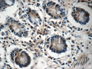 25009-1-AP - ZC3H12A
