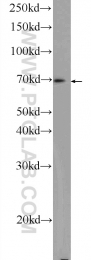 25009-1-AP - ZC3H12A