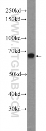 25009-1-AP - ZC3H12A