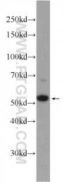 24991-1-AP - ZC3H12D