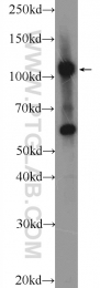 25624-1-AP - ZC3H7B