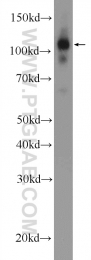 25624-1-AP - ZC3H7B