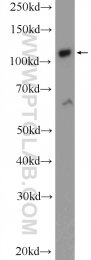 25624-1-AP - ZC3H7B