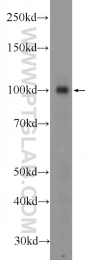 16820-1-AP - ZC3HAV1