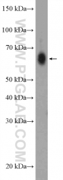 22412-1-AP - ZCCHC7
