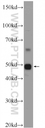 25985-1-AP - ZDHHC7