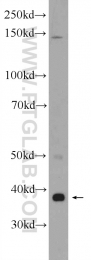 24046-1-AP - ZDHHC9