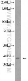 24046-1-AP - ZDHHC9
