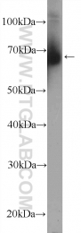 26120-1-AP - ZFP90