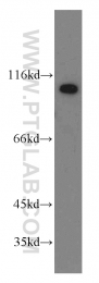 20136-1-AP - ZHX2