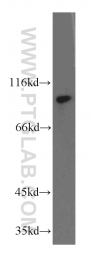 20136-1-AP - ZHX2