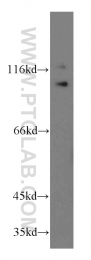 20136-1-AP - ZHX2