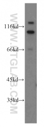 20136-1-AP - ZHX2