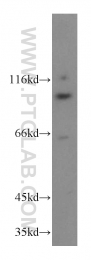 20136-1-AP - ZHX2