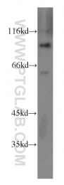 20136-1-AP - ZHX2