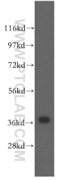 51003-1-AP - ZIC4