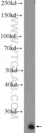25819-1-AP - ZMAT2