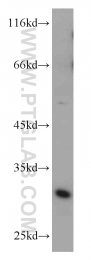 10504-1-AP - ZMAT3