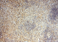 18157-1-AP - ZNF174